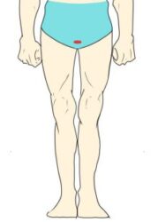 Iライン