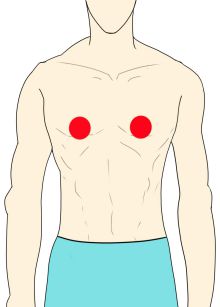 乳輪周り